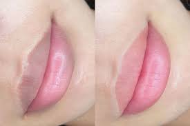 KHỬ THÂM MÔI BẰNG HOA HỒNG