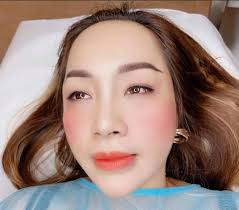PHUN MÁ HỒNG