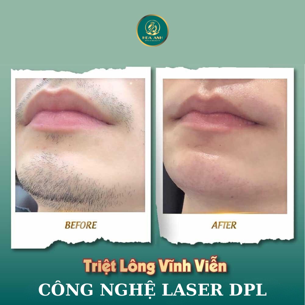 TRIỆT RÂU NAM