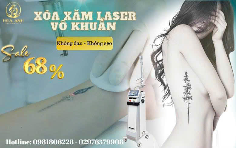 Dịch Vụ Xóa Xăm Công Nghệ Cao An Toàn – Hiệu Quả Tại Thẩm Mỹ Viện Hoa Anh