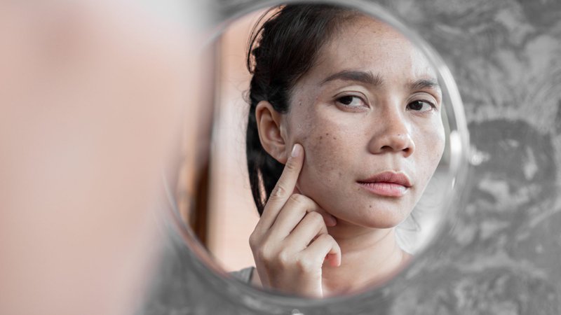 8 cách làn da phản ánh sự căng thẳng bên trong bạn