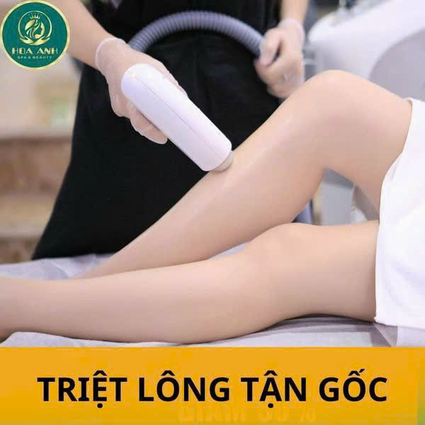 Triệt Râu Quai Nón Cho Phái Mạnh Có Thật Sự Hết Không? Chia Sẻ Thực Tế Từ Thẩm Mỹ Viện Hoa Anh