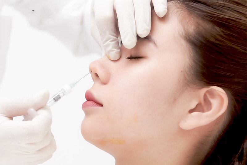 Tiêm Filler mũi duy trì được bao lâu? Có nguy hiểm không?