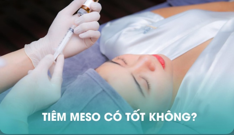 TIÊM MESOTHERAPY CÓ TỐT KHÔNG?