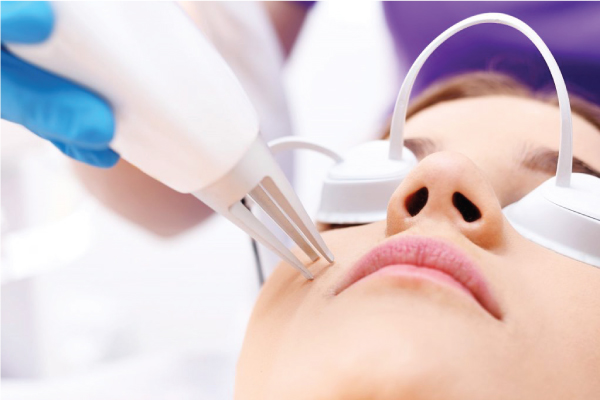 Khử thâm môi bằng Laser có nên không?