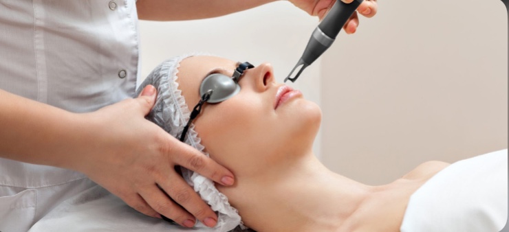 Trị nám bằng Laser có tốt không?