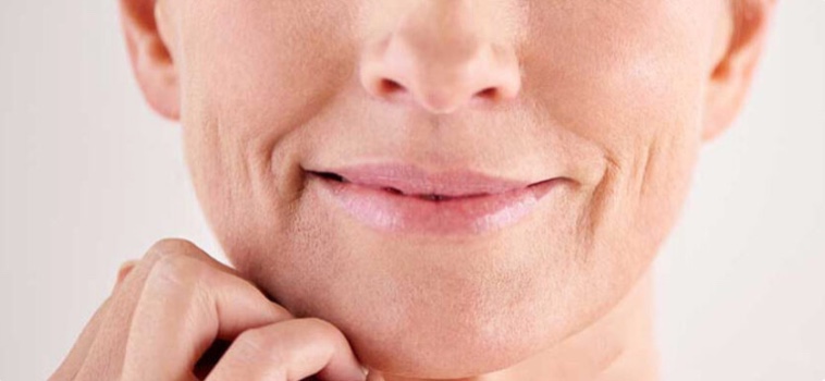 RÃNH CƯỜI: NGUYÊN NHÂN & 6+ CÁCH XÓA NẾP NHĂN RÃNH CƯỜI