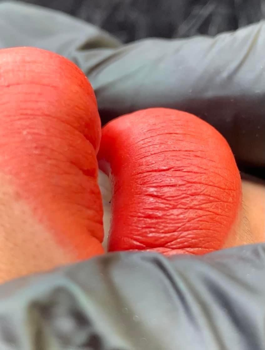 phun môi châu Âu ?