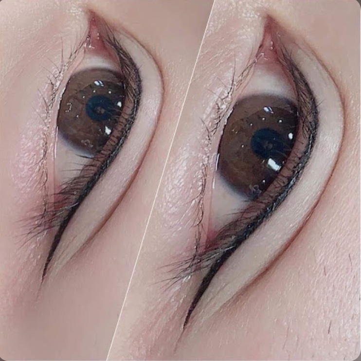 PHUN MÍ MỞ TRÒNG MẮT NAI