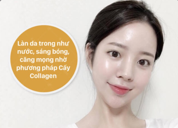 Cấy collagen tươi. Da mịn, căng bóng